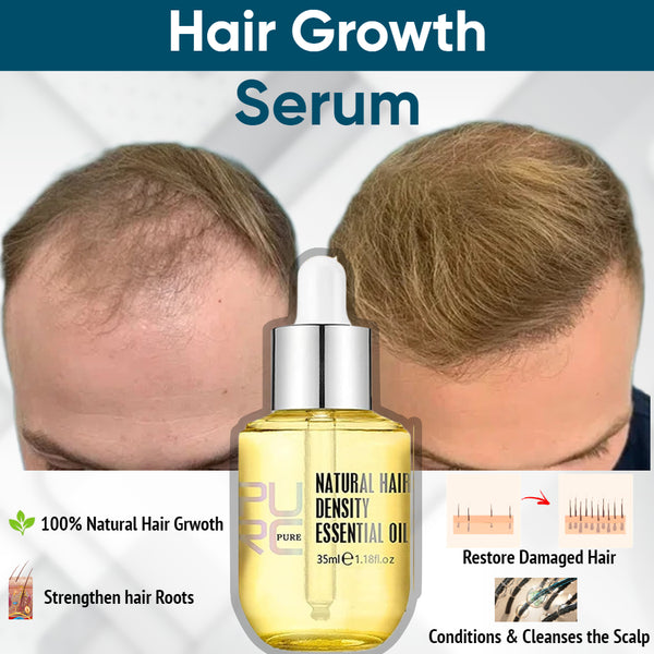 Hair Growth Serum